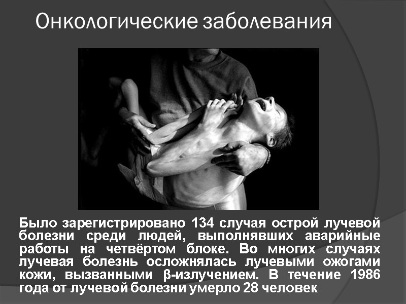 Онкологические заболевания   Было зарегистрировано 134 случая острой лучевой болезни среди людей, выполнявших